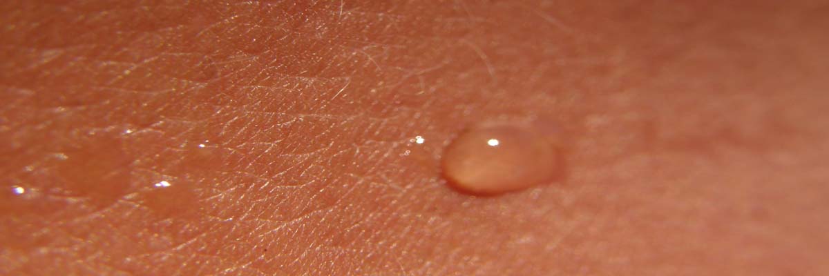 Lees meer over het artikel Is scheren slecht voor de huid?