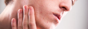 Lees meer over het artikel Een geïrriteerde huid na het scheren voorkomen?